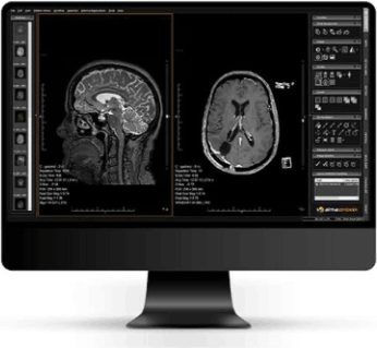 Visualizadores DICOM